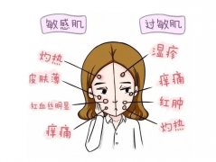 儿童皮肤过敏怎么办