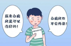 南京哪里治疗白癜风好