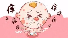 什么是季节性湿疹