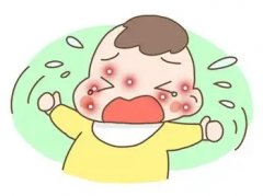 皮肤过敏红痒怎么办