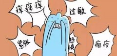 频繁的出现皮肤瘙痒怎么办