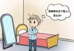 白癜风怎么治疗