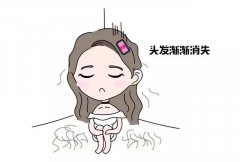 如何判断脱发是否为雄激素性脱发