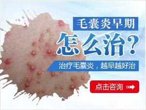 毛囊炎会自愈吗?是否需要治疗?